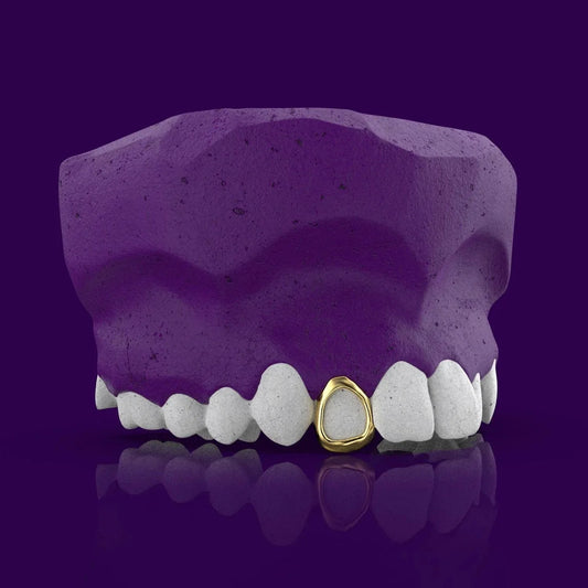 Open Face grillz
